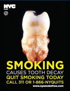 NYC graphic health warning with image of decayed tooth and text "Smoking causes tooth decay. Quit smoking today. Call 311 or 1-866-NYQUITS. www.nycsmokefree.com"